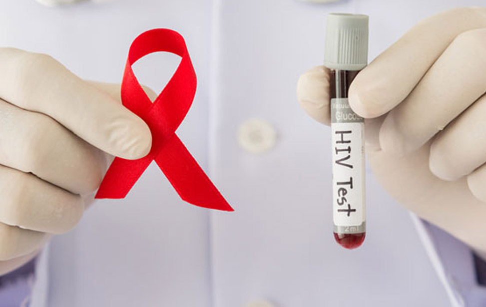 Imagen VIH un problema de salud