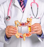 Doctor sosteniendo figura de intestino