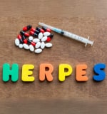 Herpes