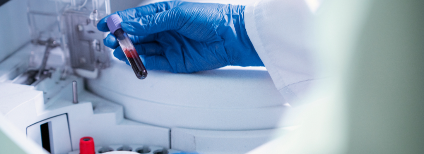 Muestra de sangre