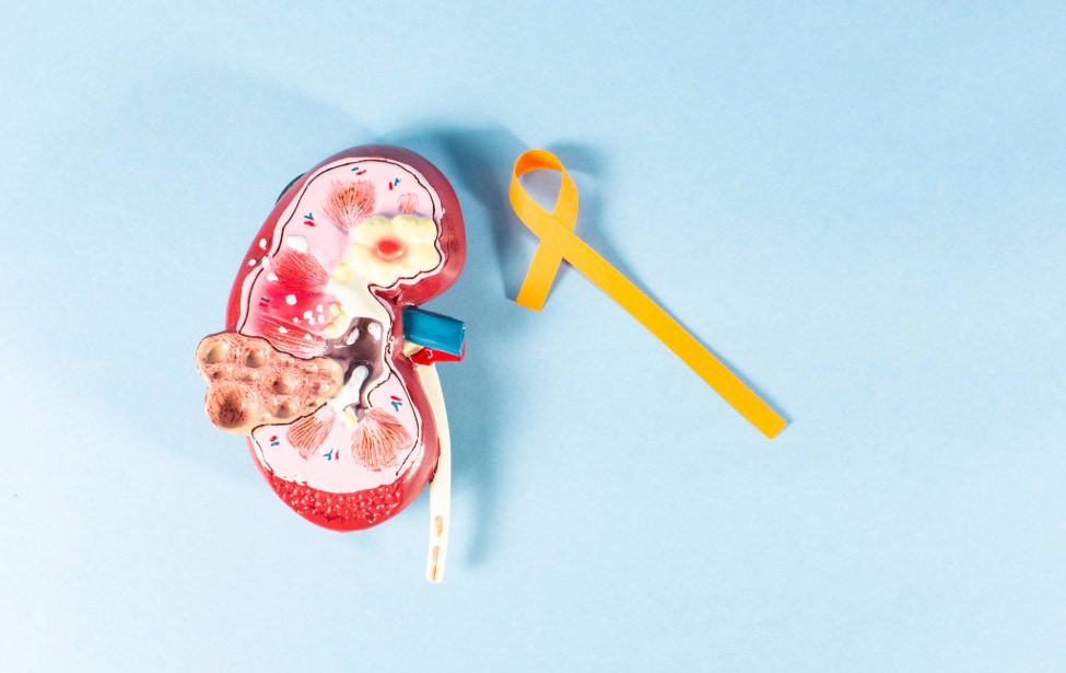 Figura de riñón con listón amarillo