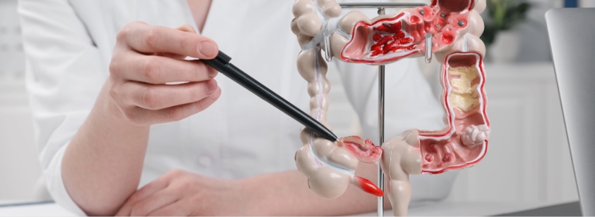 Maqueta de sistema digestivo