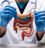 Esquema de intestino