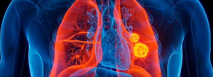 Ilustración de sistema pulmonar