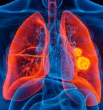 Ilustración de sistema pulmonar